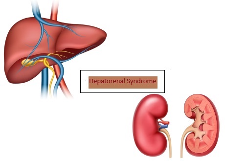 Hepatorenal Syndrome